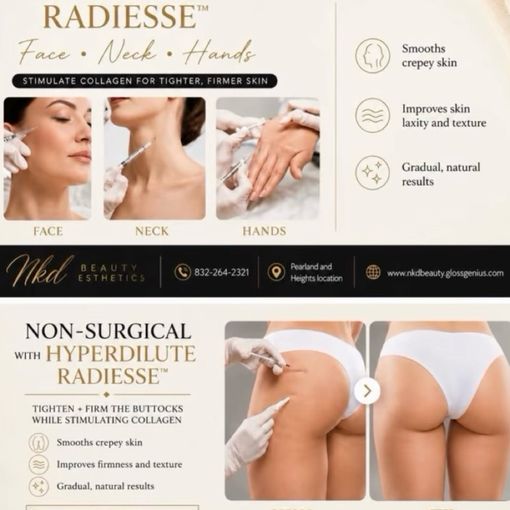 Radiesse at Nkd Beauty Esthetics in Pearland, TX