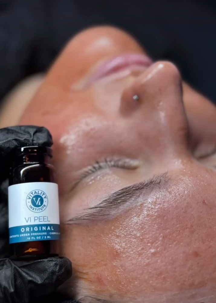 Two VI Peels|One Microneedling