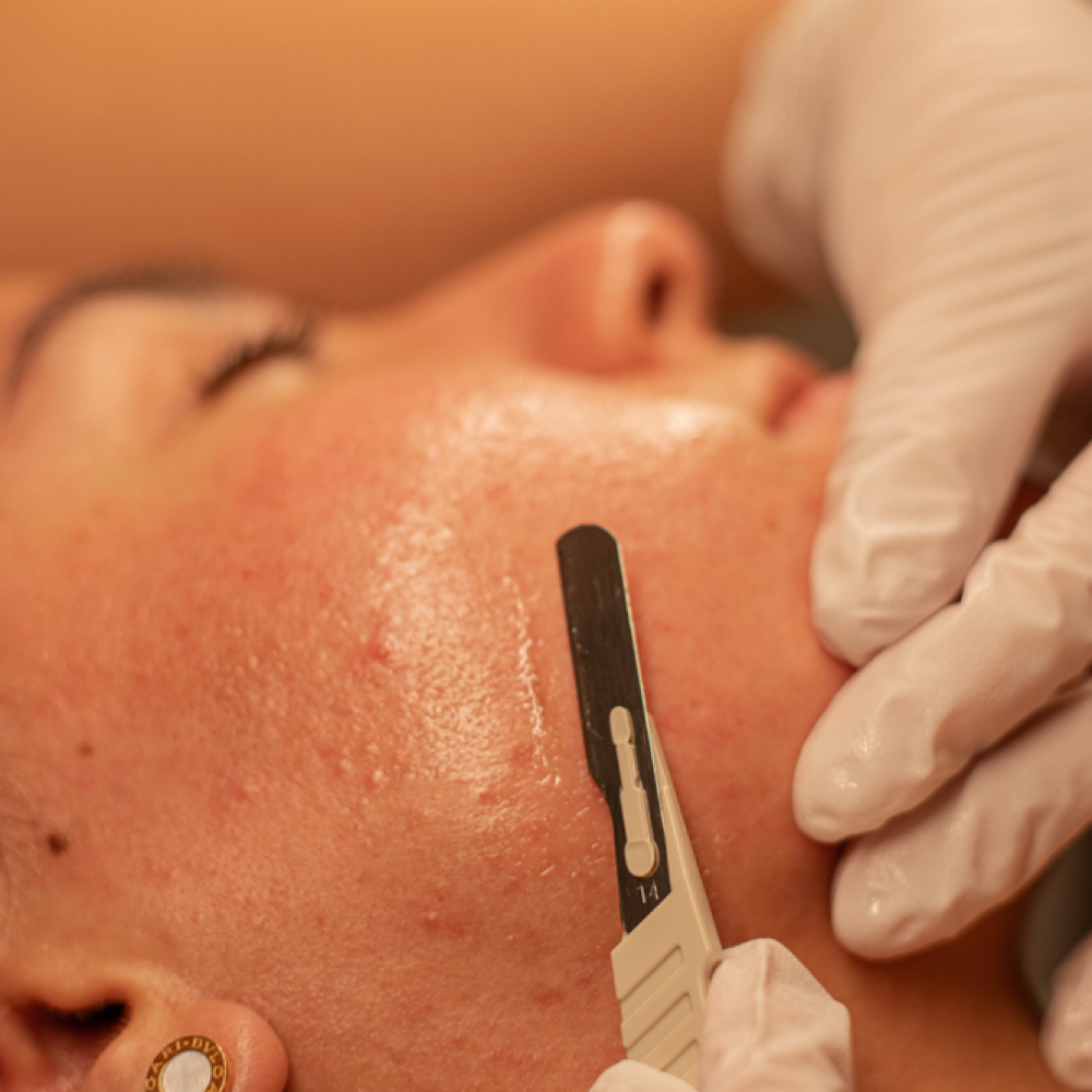 DERMA DELUXE FACIAL at MySkin Aesthetics in Laredo, TX