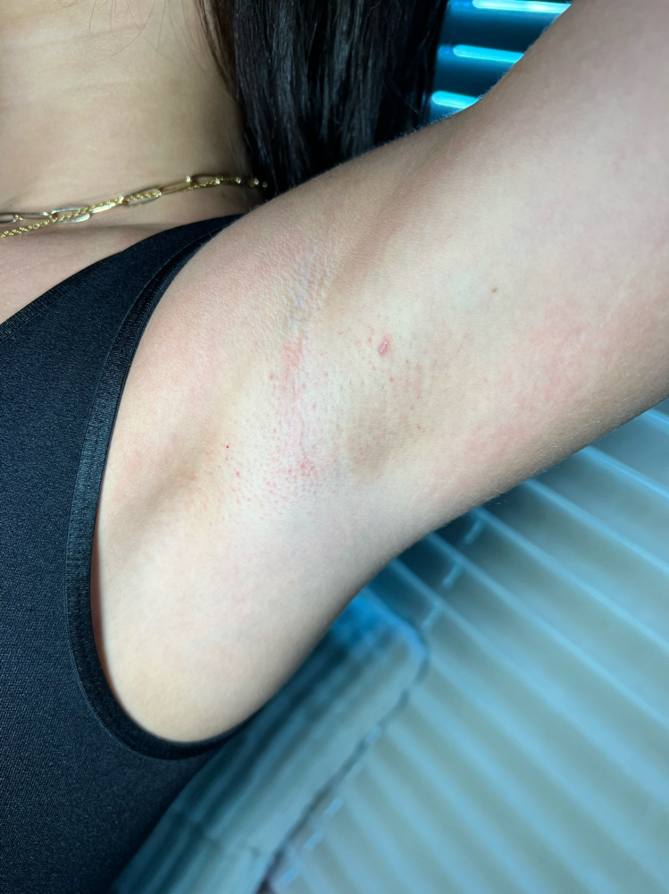 Underarm Wax