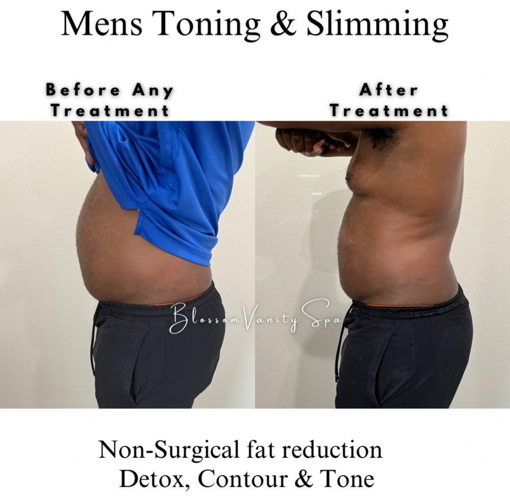Mens Toning Treatment at Blossom Vanity Spa in Missouri City, TX
