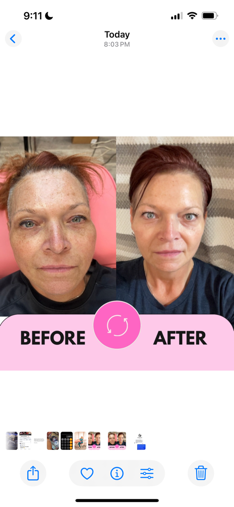Wrinkle Treatment Consult