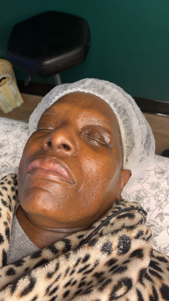 Classic Facial w/ Extractions/LED