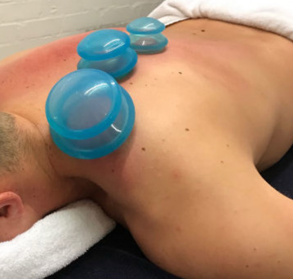 Cupping Therapy (Add On)