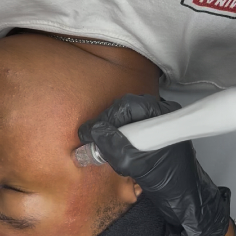7-in-1 Hydrafacial at LuxurybyLarella in Houston, TX
