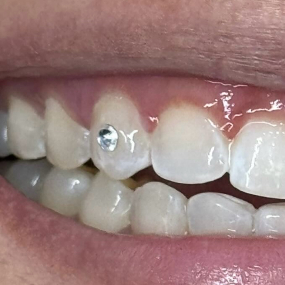 Friday The 13th Tooth Gem