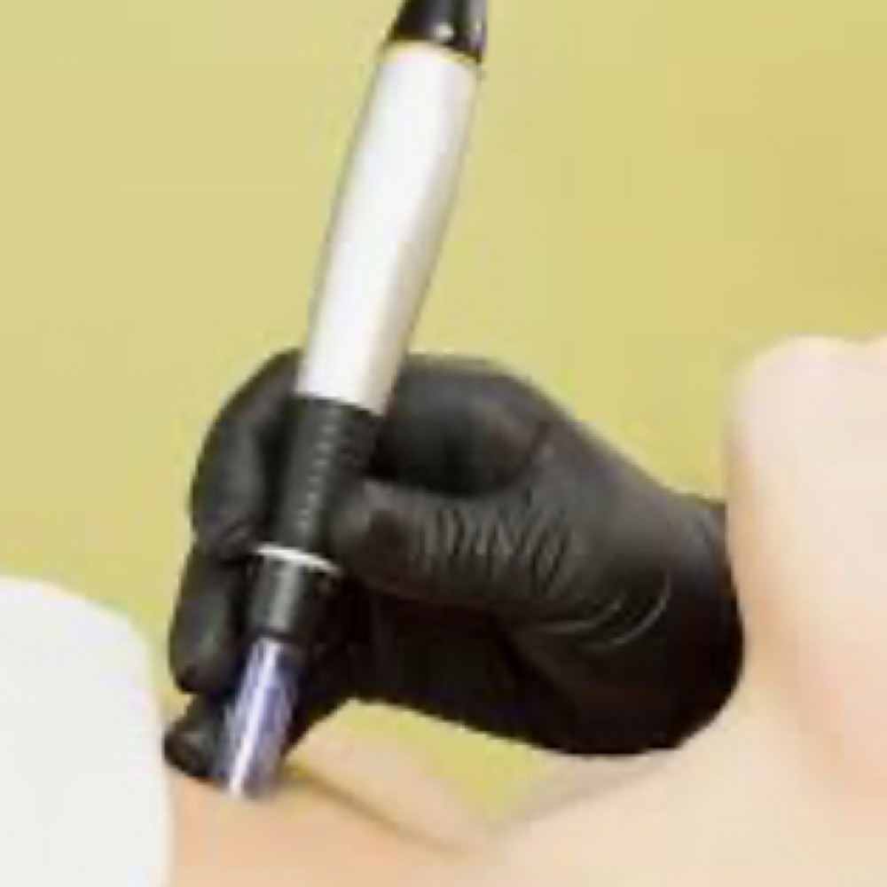 Microneedling Decolette Add-on at Vibe Skin Lab in Woburn, MA