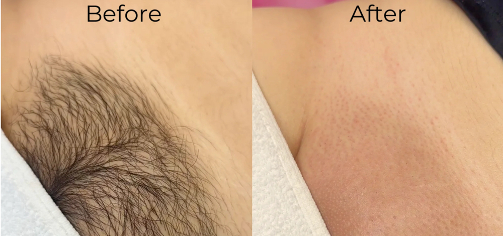 FIRST TIME CLIENTS (Only) Brazilian