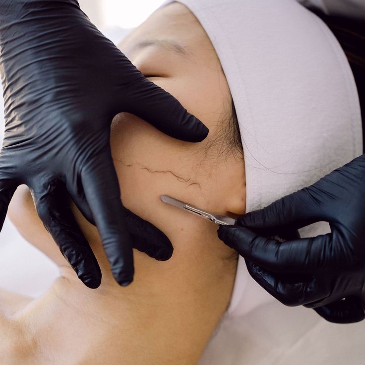 Derma-plane FacÄąal at The Heavenly Glow Beauty Studio LLC in Cleveland, OH