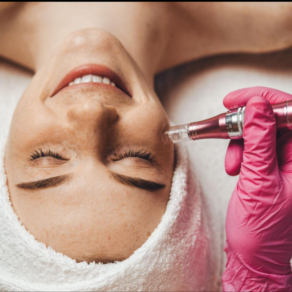 Microneedling Facial at Aura Atelier in Charlotte, NC
