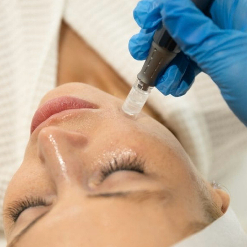 The Extreme Hydrate and Glow Facial at Get Glowin With Nichole in Sierra Madre, CA