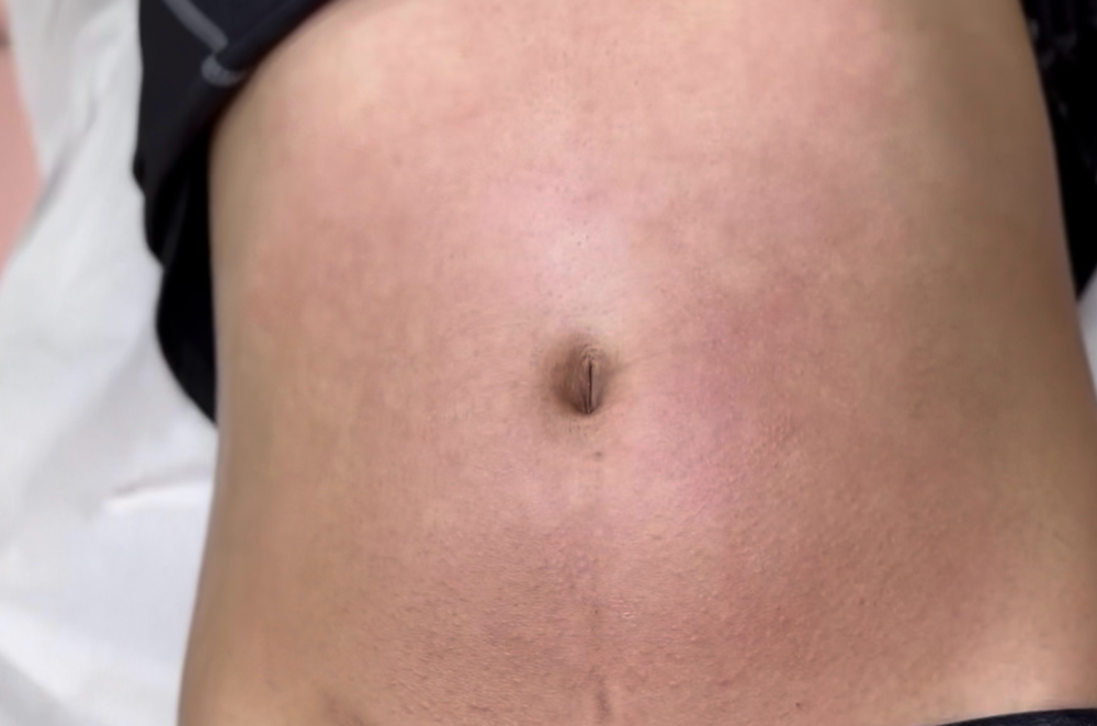 Stomach Wax