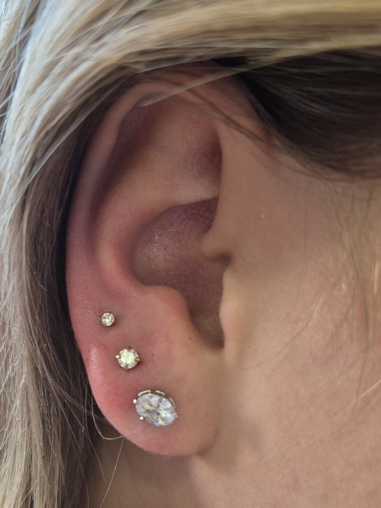 Earlobes