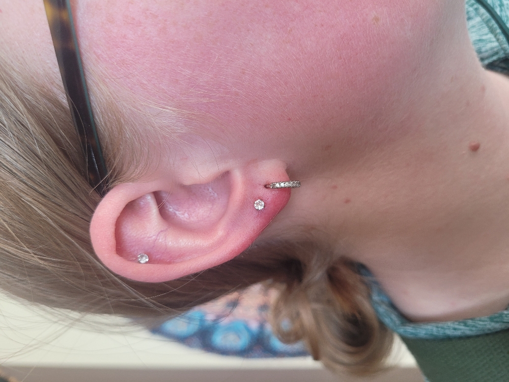 Earlobes