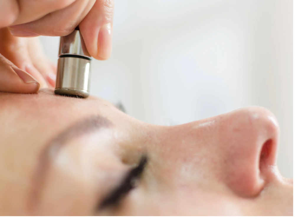 Microdermabrassion