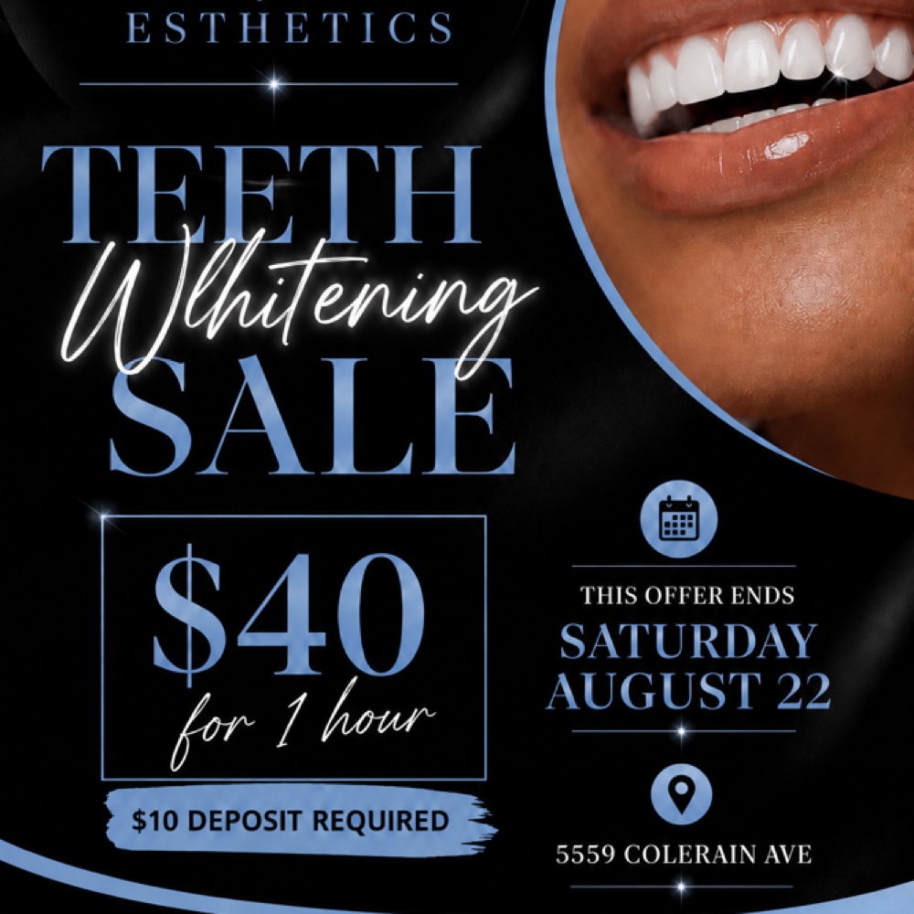 1 HourTeeth Whitening Sale at Lady V Esthetics in Cincinnati, OH