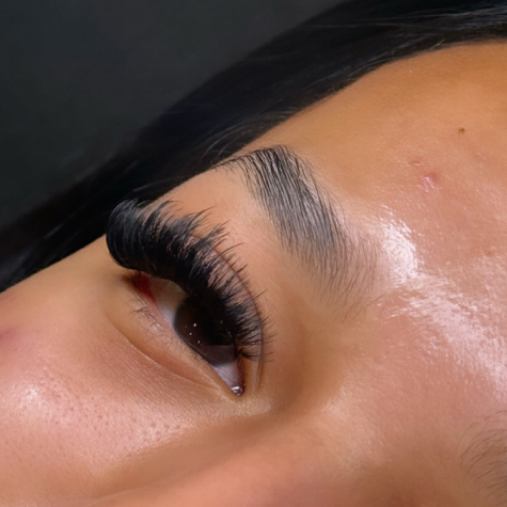 Volume Fill at KB Esthetics in Lubbock, TX