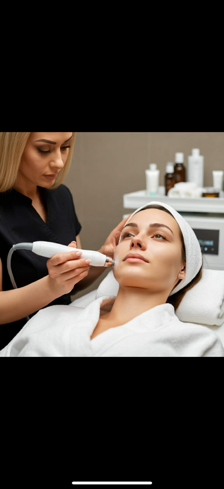 Microdermabrasion at Taylor Rose Aesthetics in Altoona, WI