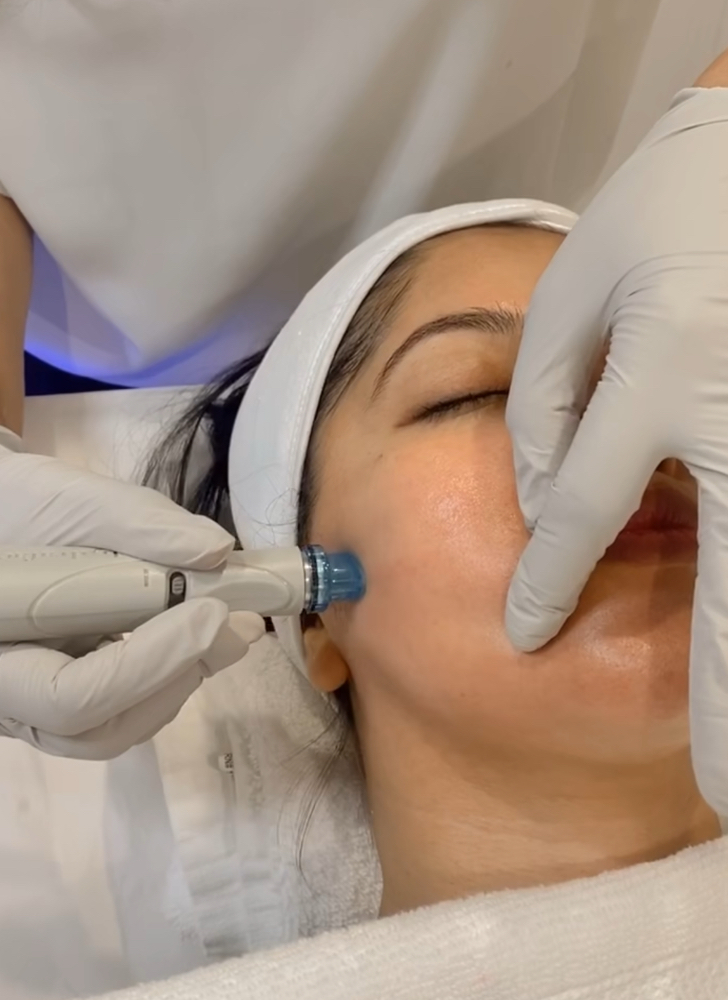 Signature Hydro Facial