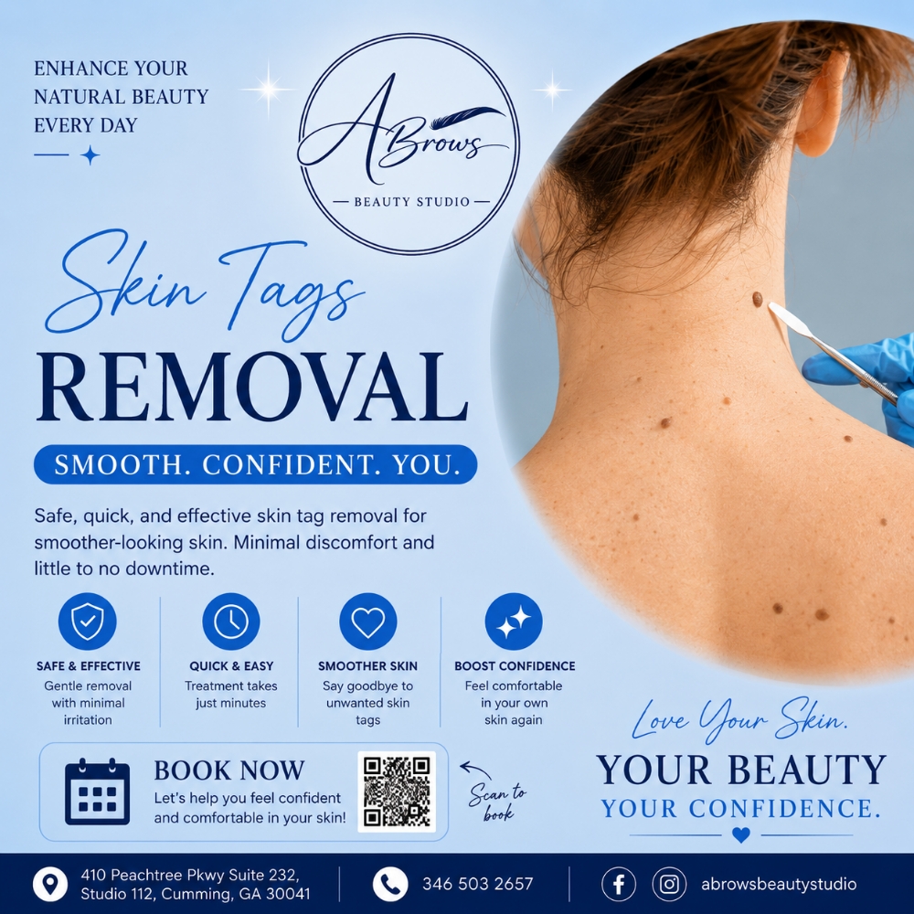 Skin Tags Removal 15% OFF at Abrows Beauty Studio in Cumming, GA
