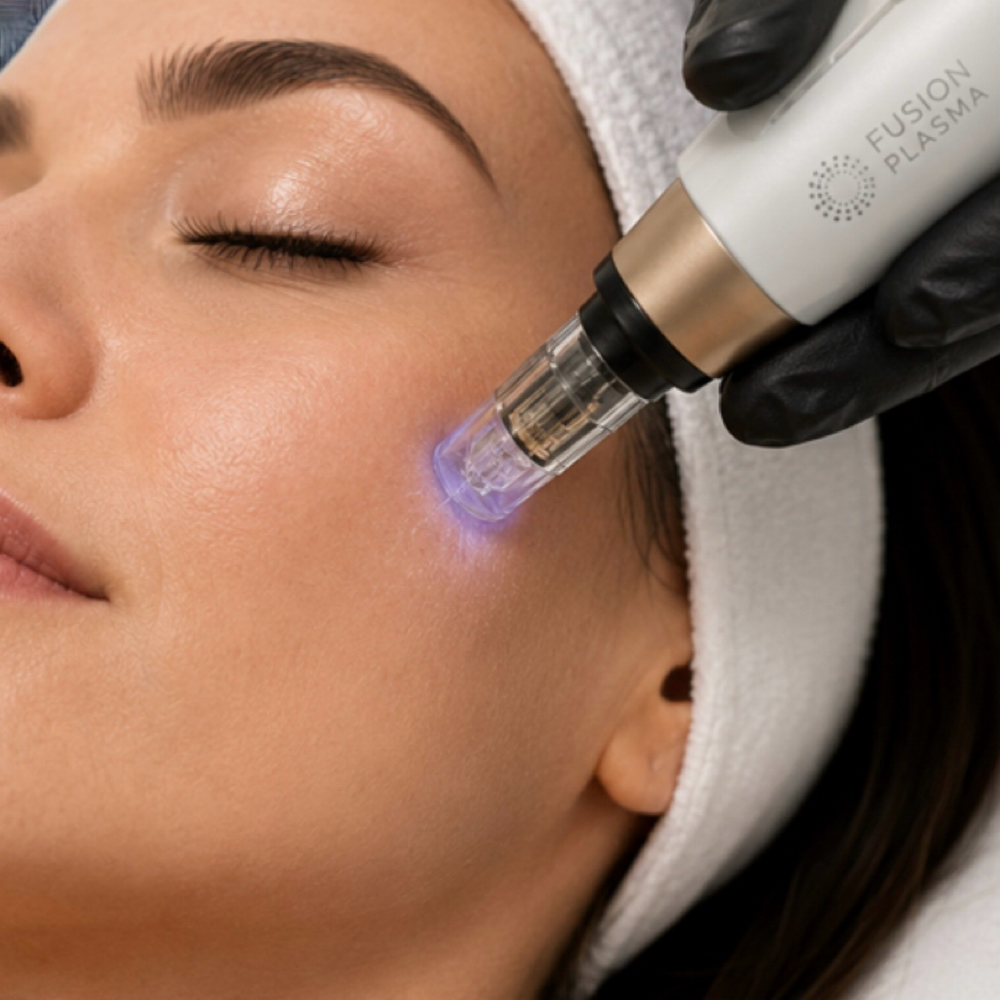 Fusion Micro-Needling at Plasmalift Skin Clinic LLC in Bettendorf, IA