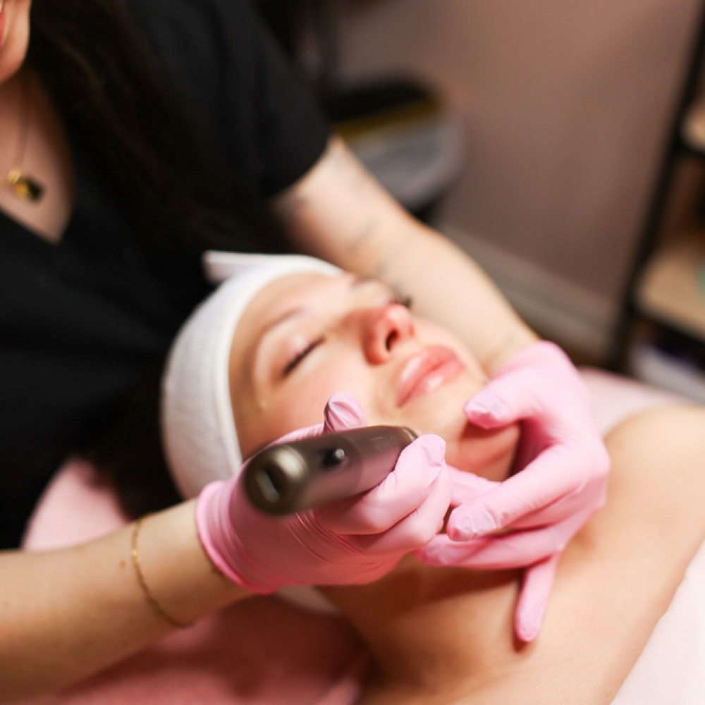 Nanoneedling at BeautybyC in Centreville, MD