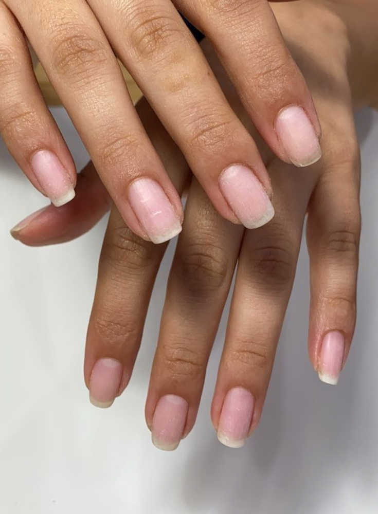 🩷 Nail Removal 🩷