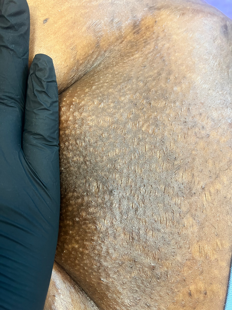 Brizillian Wax (New Clients Only)