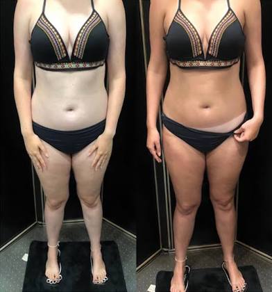 Spray Tan (Medium)