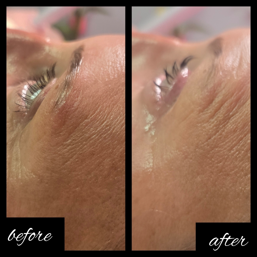 Lash Lift
