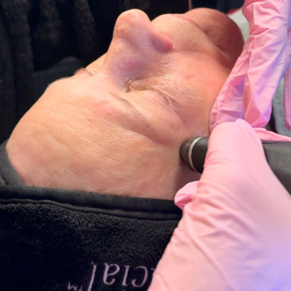 HydraFacial Perk Eye at Elevate by Arline Transformational Skin & Effortless Beauty in Cedar Park, TX