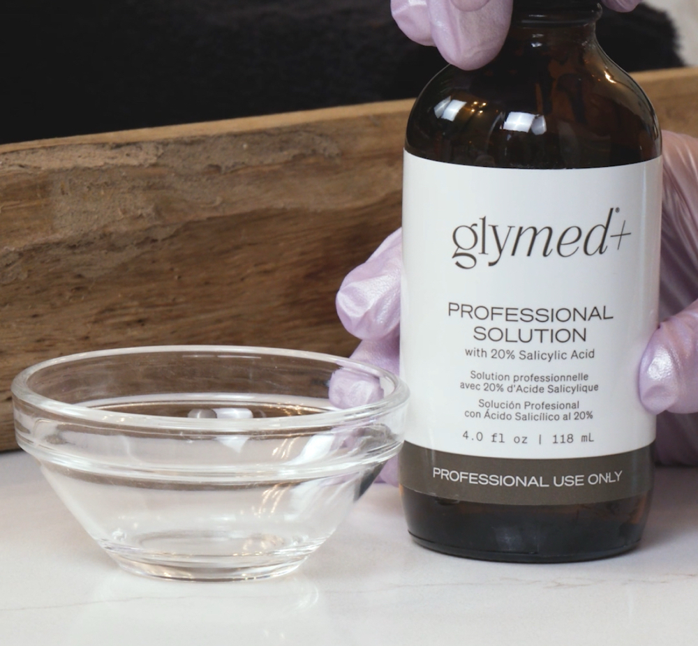 Cosmic Chemical Peel