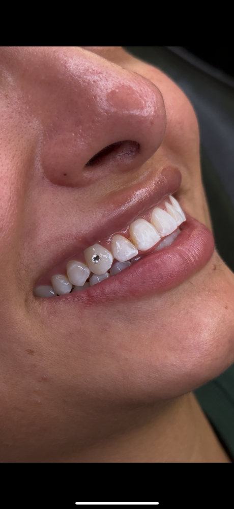 Single Crystal Tooth Gem