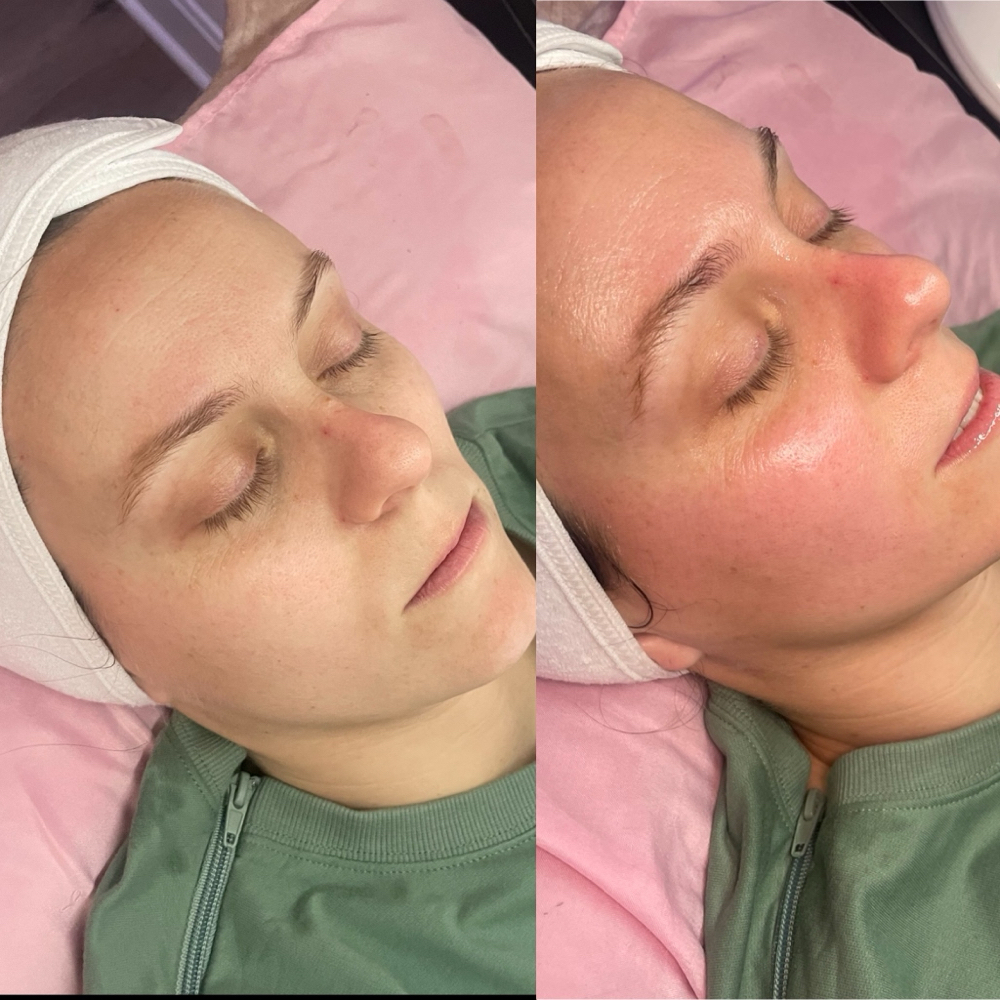 The Princess Treatment Facial
