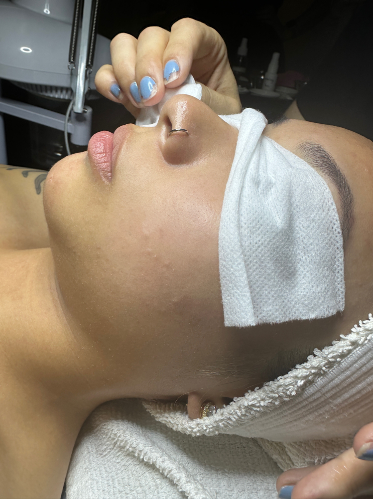 Oxygen Infusion Facial