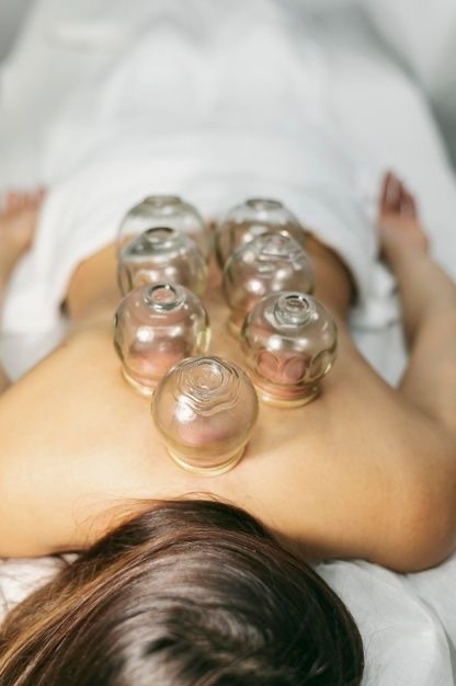 Add On - Cupping