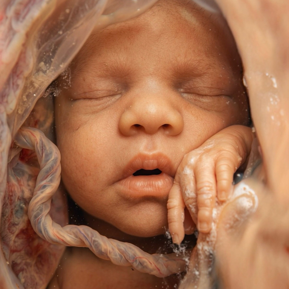 Womb View (Add-on Service) at Sweet Peeks Imaging in Winter Garden, FL