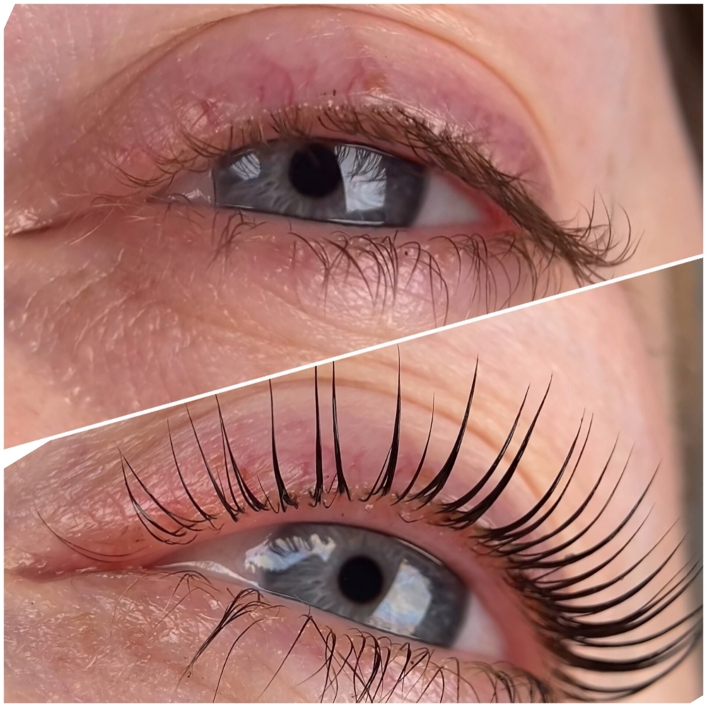 ✨️Deal Of The Month 2✨️Lift & Tint