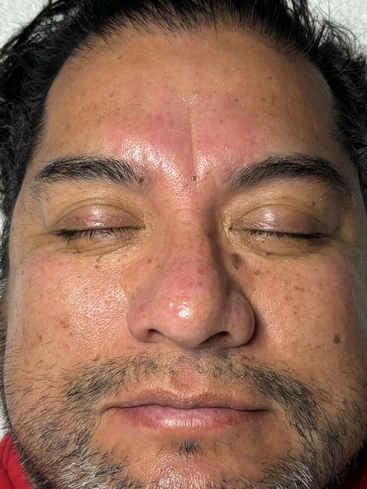 Basic Facial