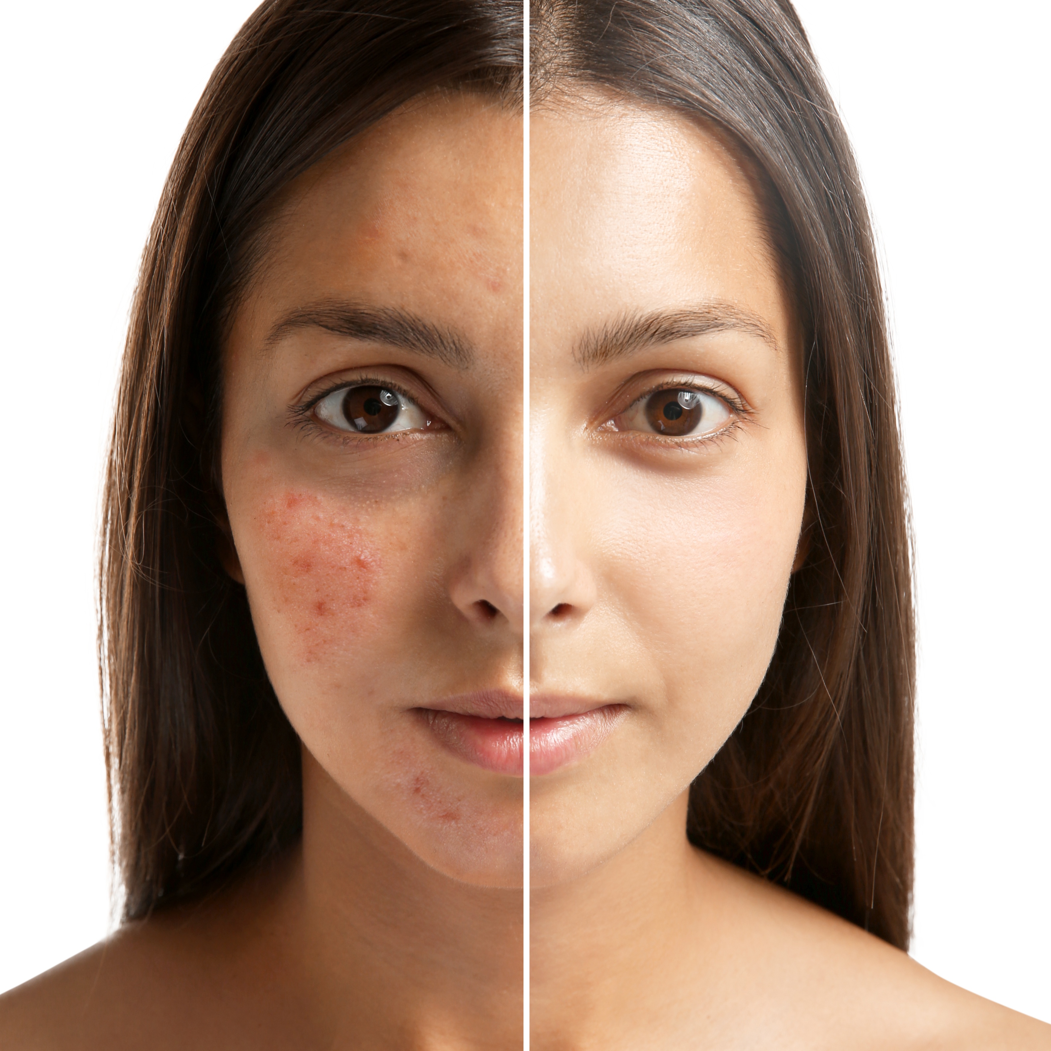 CLARIFY at Metamorphix Skin in Gaithersburg, MD