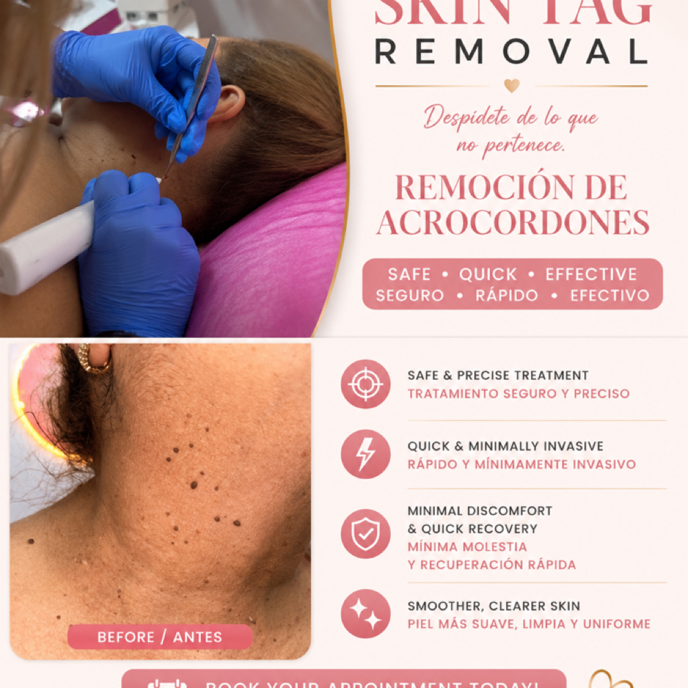 Skin Tag Removal at Honest Health and Wellness in Homestead, FL