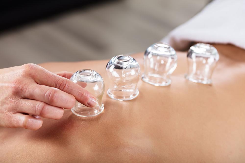 Cupping *Enhancement*