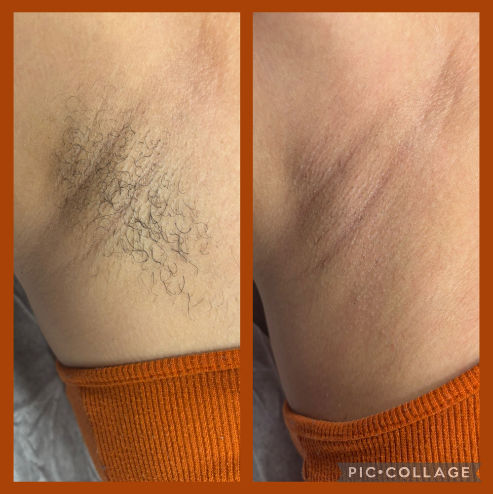 Under Arm