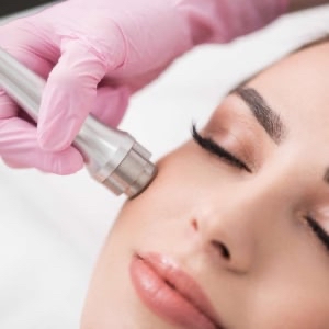 Microdermabrasion Facial