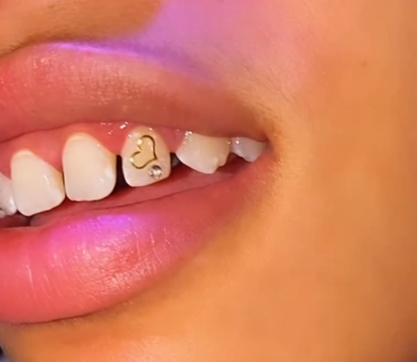 Gold Decal + One Tooth Gem💎