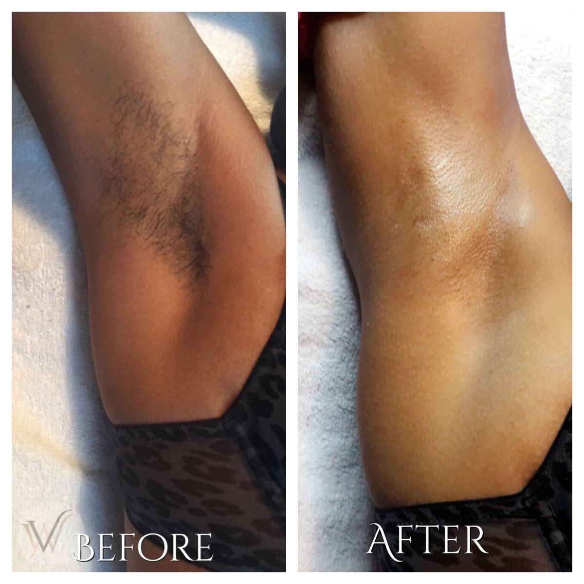 Underarm Wax at Shakiyla  Ross in Florissant, MO