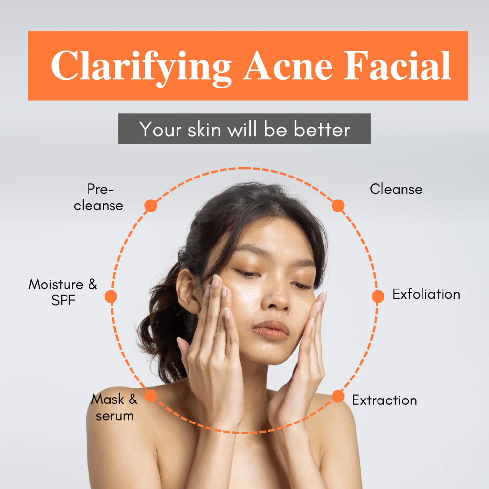 Clarifying Acne Facial