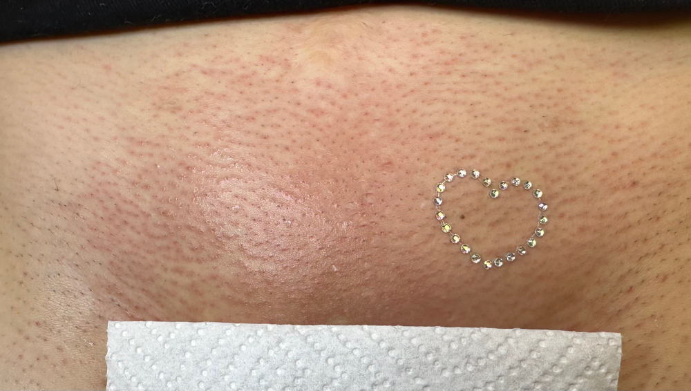Brazilian Wax