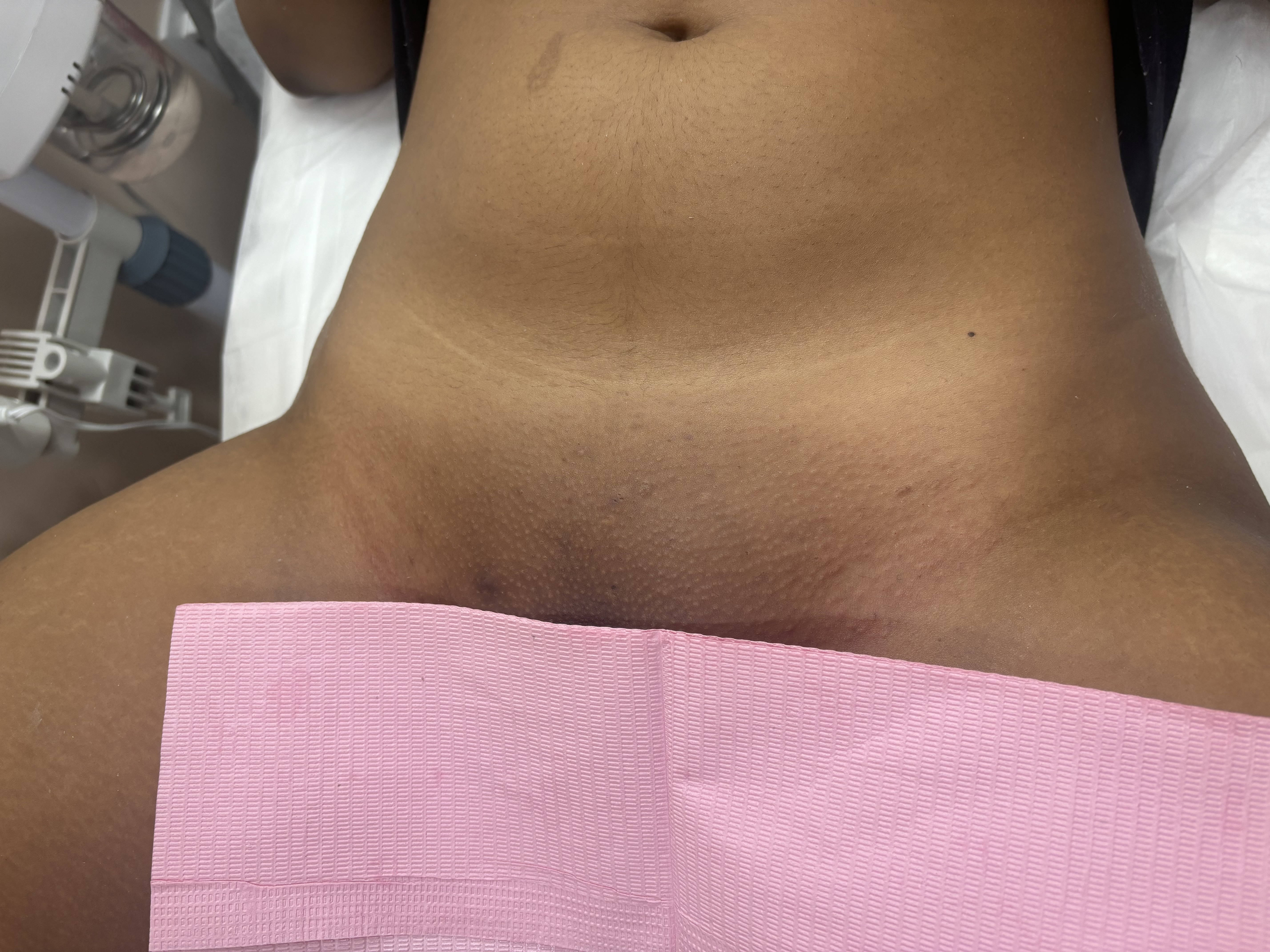 Brazilian Wax at Flawless By Fabiola in Baldwin, NY