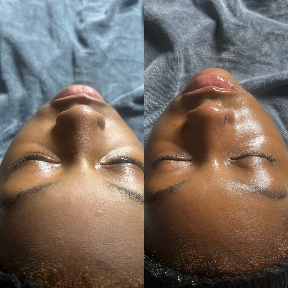 Basic Custom Facial